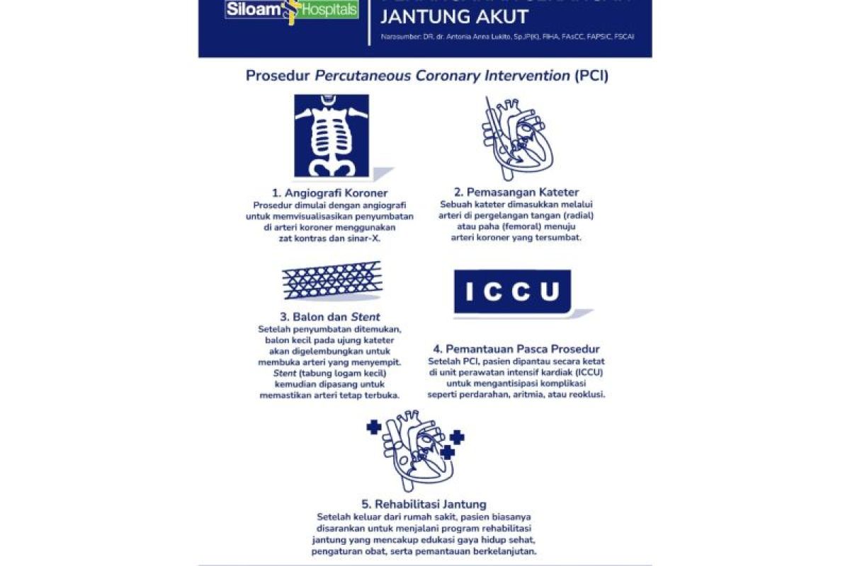 Mengenal gejala dan prosedur PCI untuk serangan jantung akut